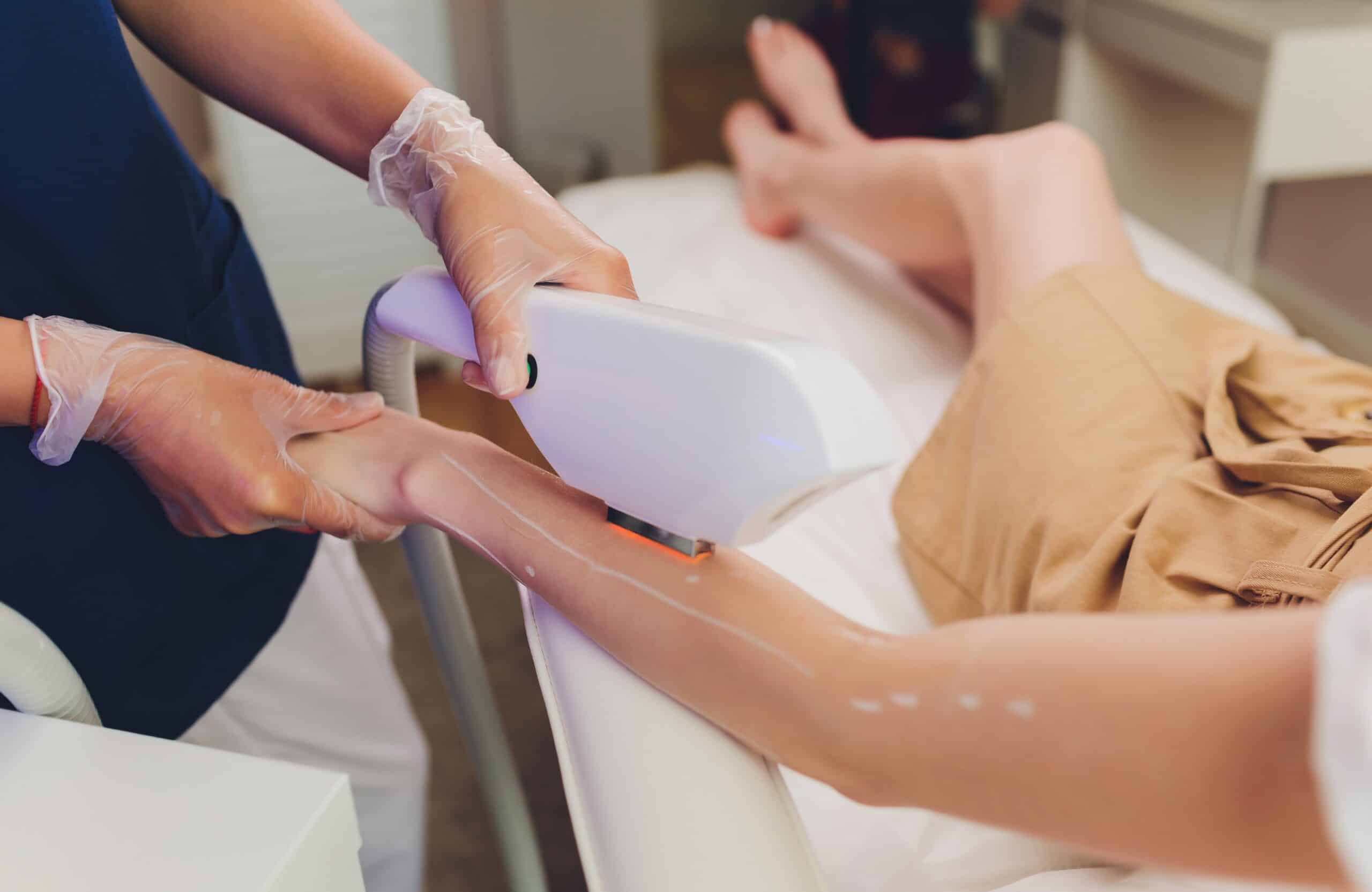 Laser Hair Removal