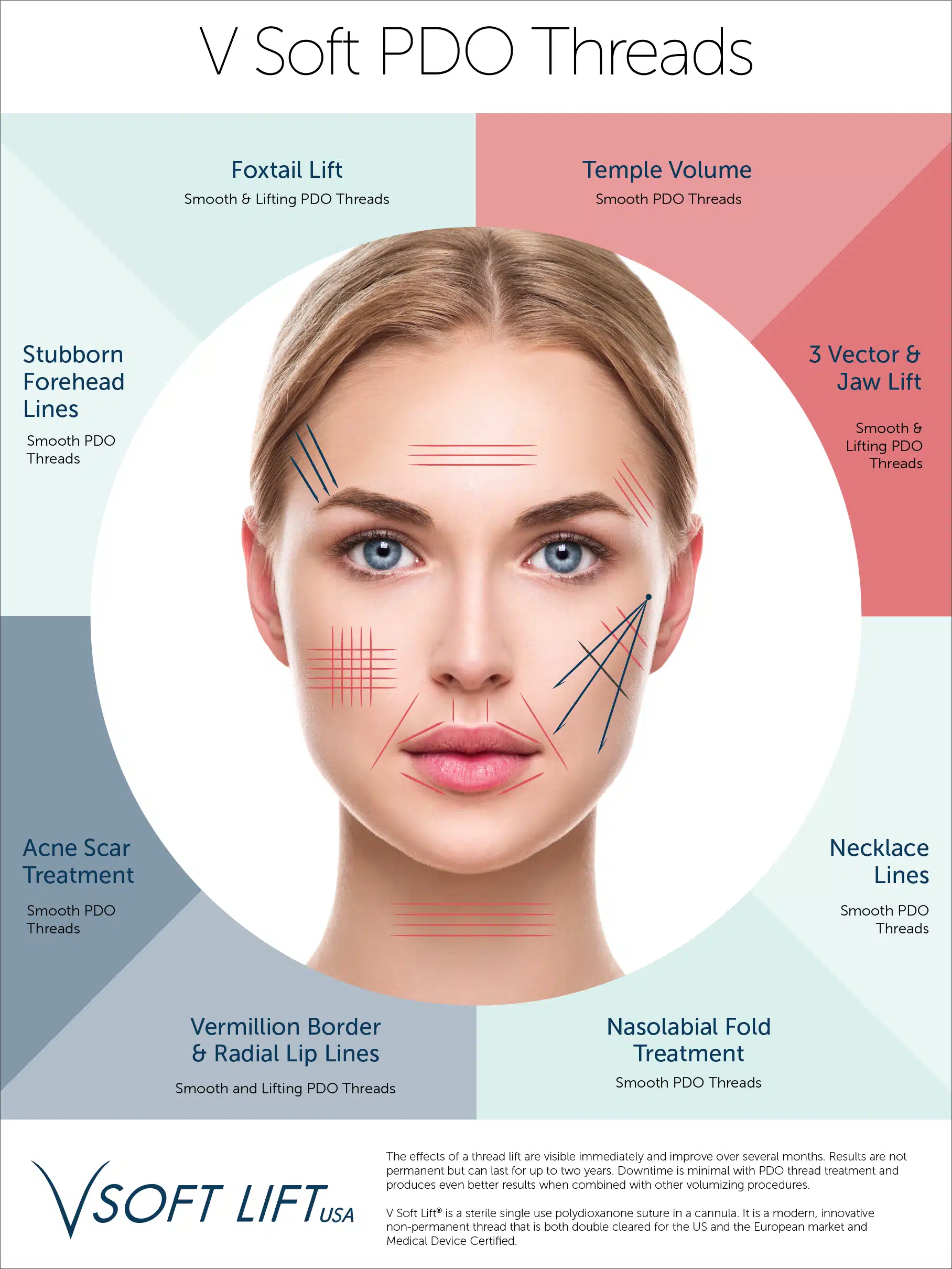V Soft PDO Threads - Wheel of Treatments